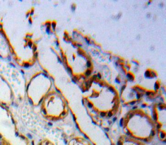 Polyclonal Antibody to Adiponectin Receptor 1 (ADIPOR1)