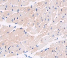 Polyclonal Antibody to Coagulation Factor VIII Associated Protein 1 (F8A1)