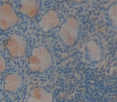 Polyclonal Antibody to Carcinoembryonic Antigen (CEA)