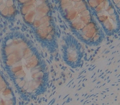 Polyclonal Antibody to Carcinoembryonic Antigen (CEA)