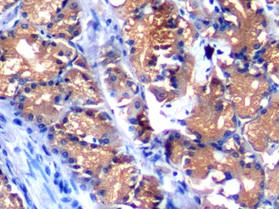 Polyclonal Antibody to Alpha-Fetoprotein (AFP)