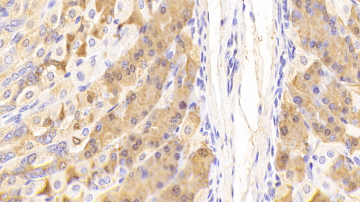 Polyclonal Antibody to Pepsinogen C (PGC)