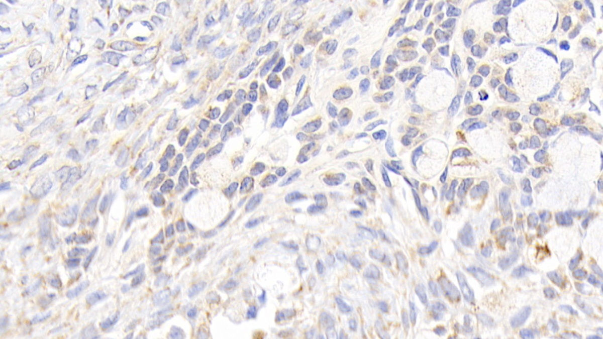 Polyclonal Antibody to Prostaglandin E Synthase, Microsomal (PTGES)