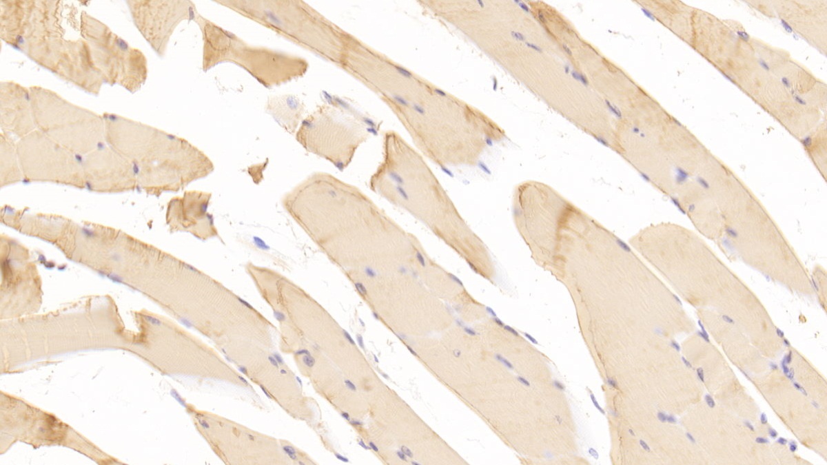 Polyclonal Antibody to Prostatic Acid Phosphatase (PAP)