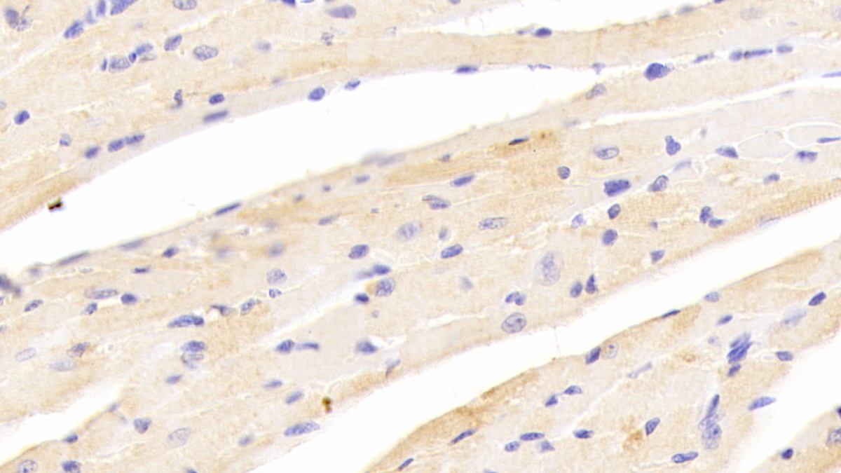 Polyclonal Antibody to Glucosidase Alpha, Acid (GaA)