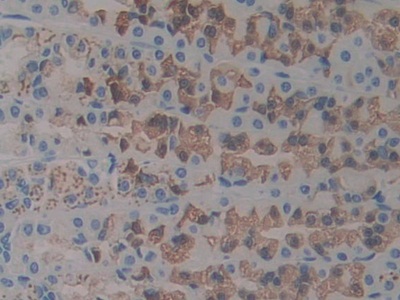 Polyclonal Antibody to Interferon Alpha 2 (IFNa2)