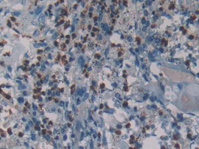 Polyclonal Antibody to Neutrophil Elastase (NE)