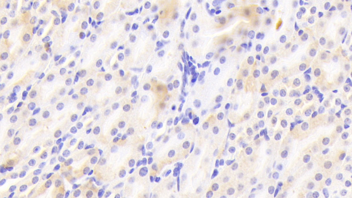 Polyclonal Antibody to Laminin Beta 1 (LAMb1)