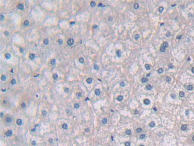 Polyclonal Antibody to Ribonuclease P (RNASEP)