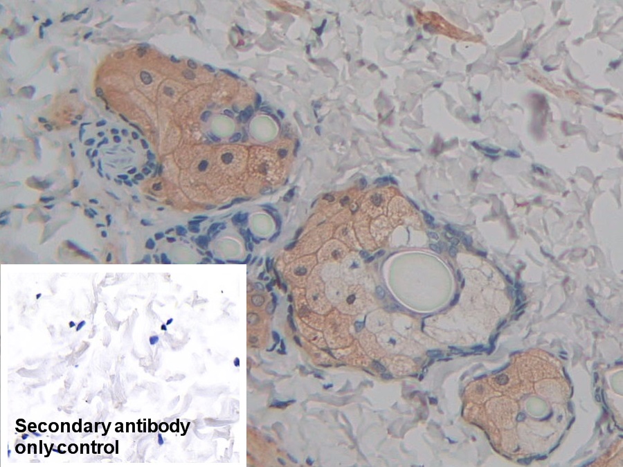 Polyclonal Antibody to Fatty Acid Binding Protein 9, Testis (FABP9)