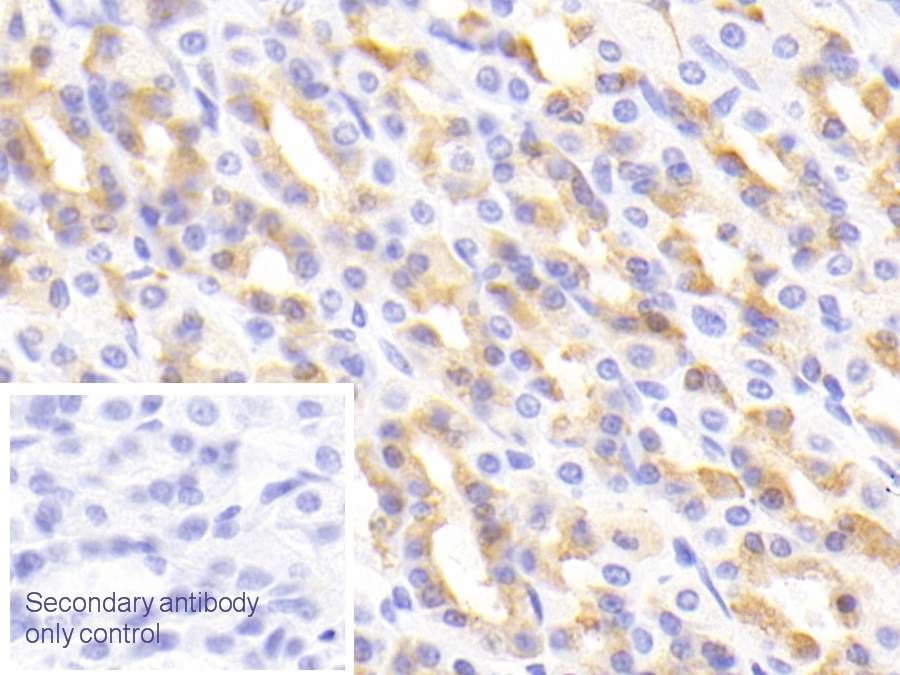 Polyclonal Antibody to Deoxyribonuclease I Like Protein 2 (DNASE1L2)