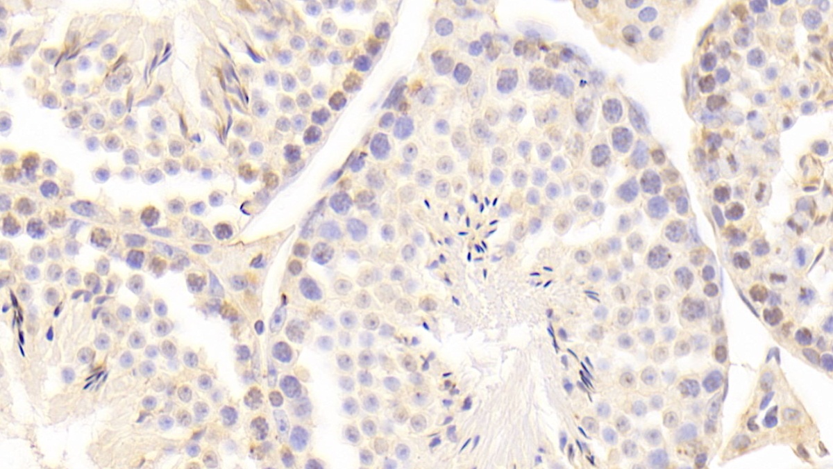 Polyclonal Antibody to Growth Arrest Specific Protein 6 (GAS6)