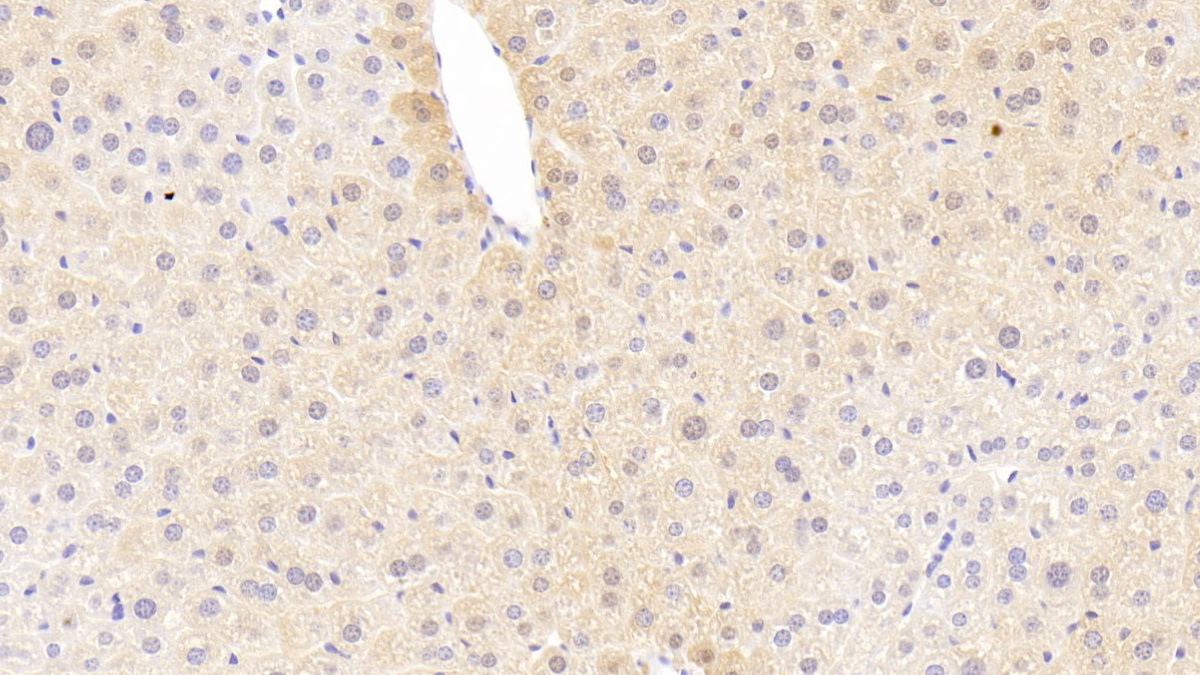 Polyclonal Antibody to Triggering Receptor Expressed On Myeloid Cells 1 (TREM1)