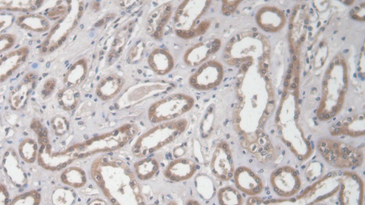 Polyclonal Antibody to Collagen Type I Alpha 2 (COL1a2)