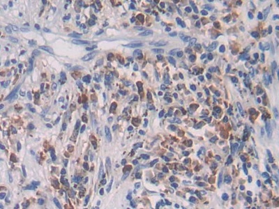 Polyclonal Antibody to Transforming Growth Factor Beta 2 (TGFb2)