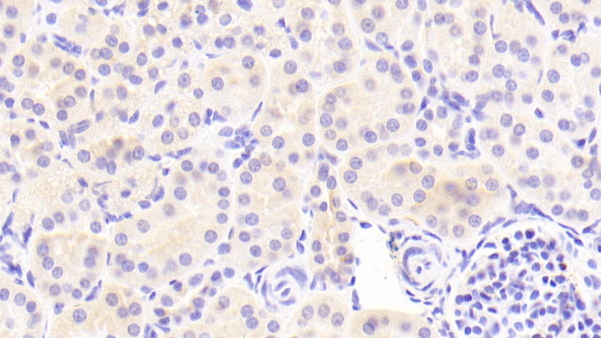 Polyclonal Antibody to Prostaglandin E Receptor 1 (EP1)