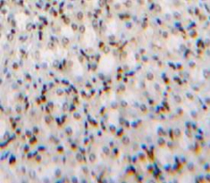 Polyclonal Antibody to Transcription factor 20 (TCF20)