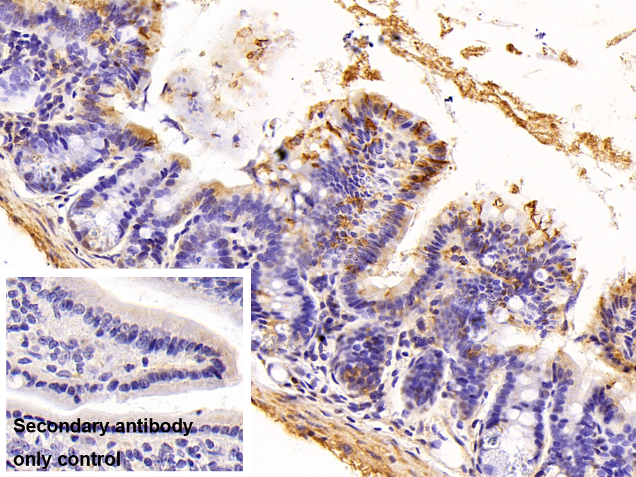 Polyclonal Antibody to Free Fatty Acid Receptor 3 (FFAR3)