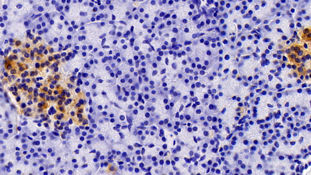 Polyclonal Antibody to Anti-Mullerian Hormone (AMH)