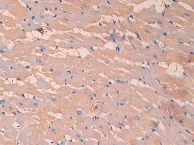 Polyclonal Antibody to Urocortin (UCN)