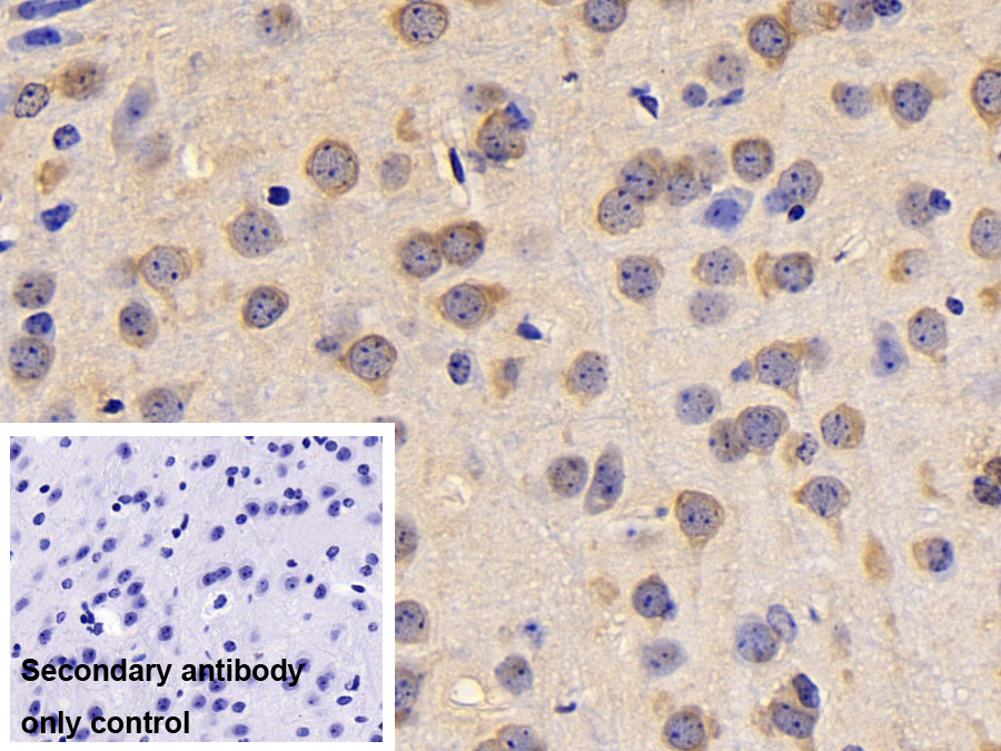 Polyclonal Antibody to Protein Kinase C Eta (PKCh)