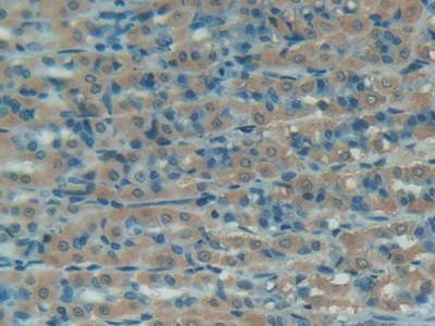 Polyclonal Antibody to Complement 1 Inhibitor (C1INH)