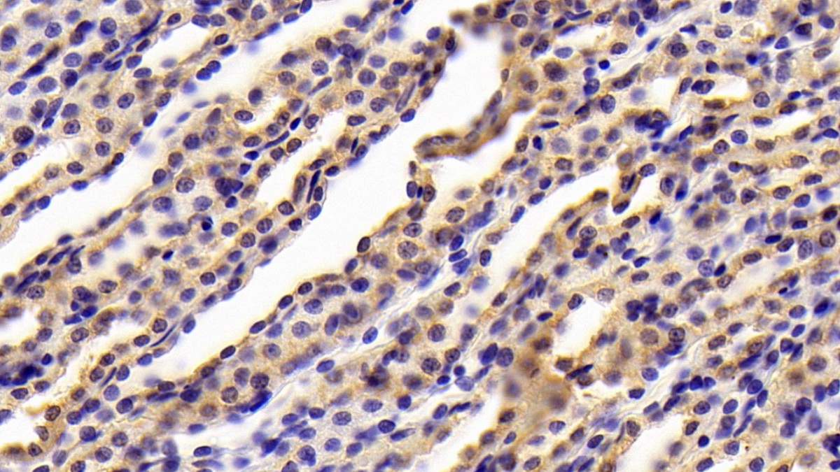 Polyclonal Antibody to Complement 1 Inhibitor (C1INH)