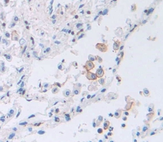 Polyclonal Antibody to Prostaglandin E Receptor 2 (EP2)