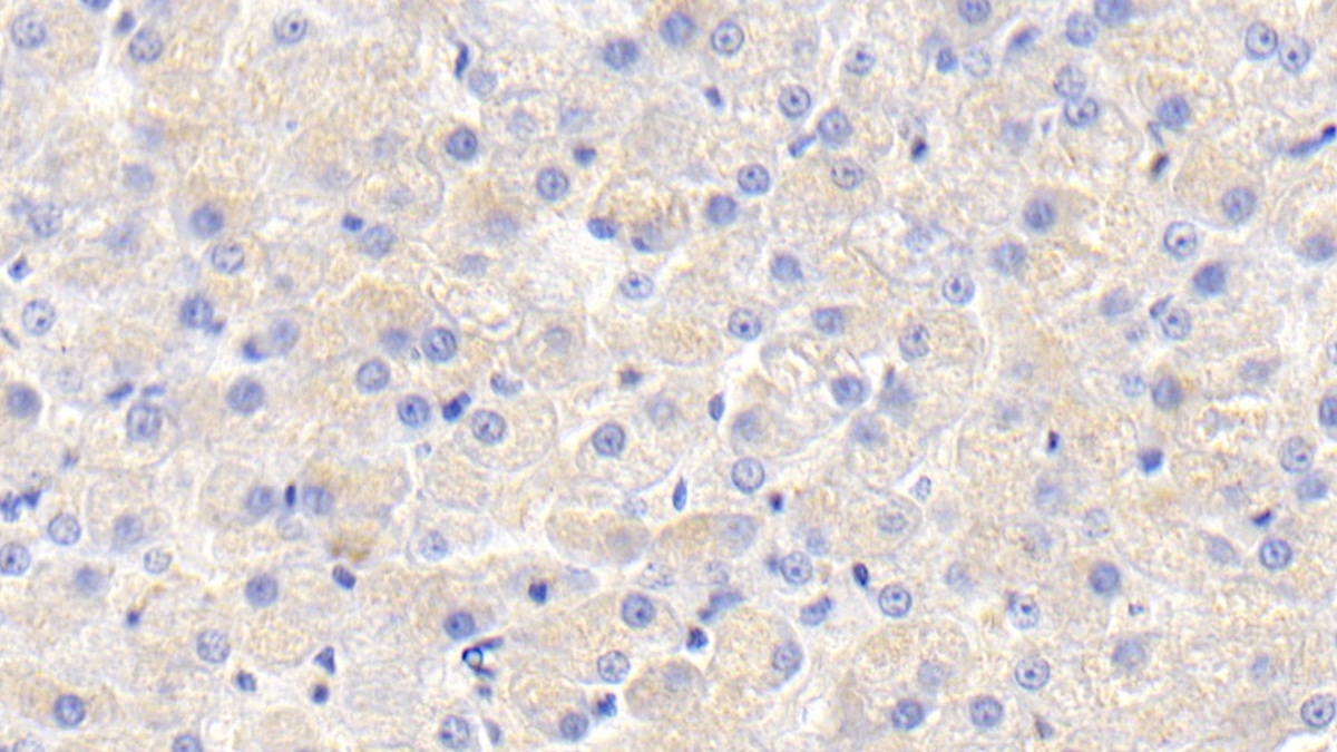 Polyclonal Antibody to Apolipoprotein C1 (APOC1)