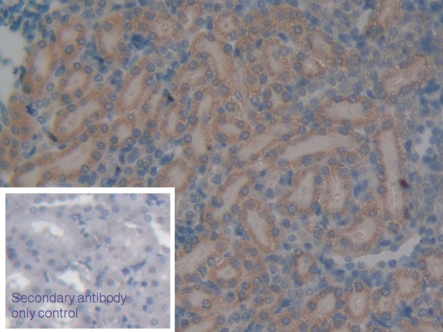 Polyclonal Antibody to N-Acetylgalactosamine-6-Sulfatase (GALNS)