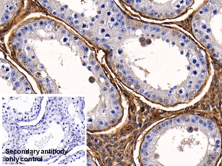 Polyclonal Antibody to Annexin V (ANXA5)