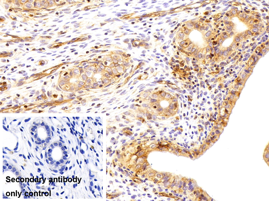 Polyclonal Antibody to Beta-2-Microglobulin (b2M)