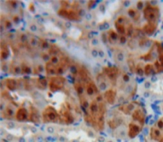 Polyclonal Antibody to Cathepsin K (CTSK)