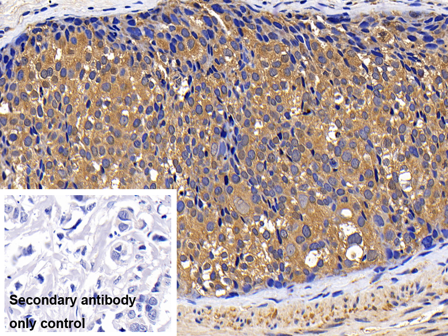 Polyclonal Antibody to Cathepsin K (CTSK)