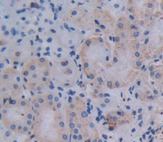 Polyclonal Antibody to Cathepsin K (CTSK)