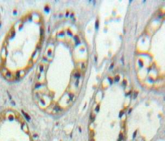 Polyclonal Antibody to Integrin Alpha D (ITGaD)