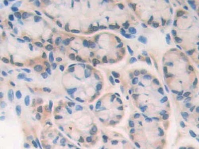 Polyclonal Antibody to Poly ADP Ribose Polymerase (PARP)