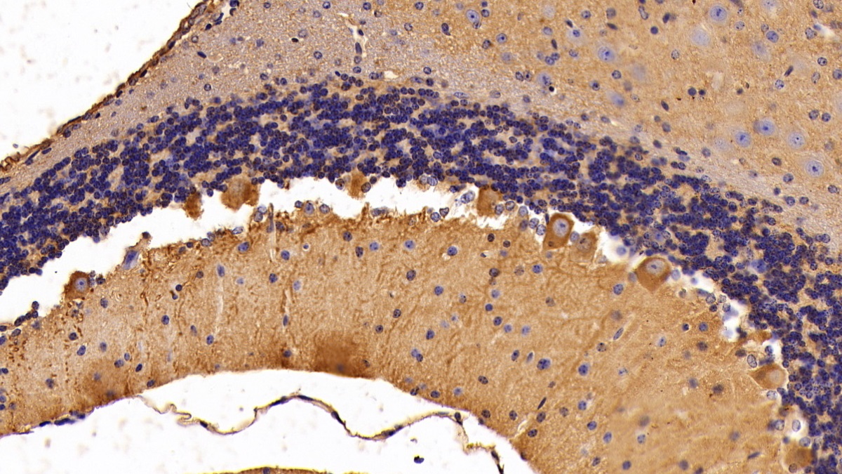 Polyclonal Antibody to Alpha-Fodrin (SPTAN1)