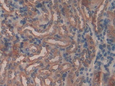 Polyclonal Antibody to Alpha-Fodrin (SPTAN1)