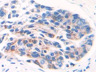 Polyclonal Antibody to Glutamate Dehydrogenase 1 (GLUD1)