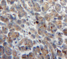 Polyclonal Antibody to Neutrophil Cytosolic Factor 2 (NCF2)