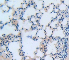 Polyclonal Antibody to Neutrophil Cytosolic Factor 2 (NCF2)