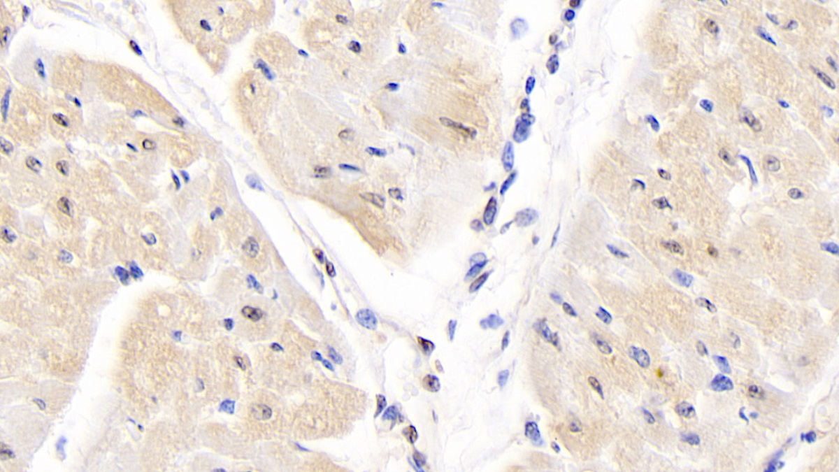 Polyclonal Antibody to Heat Shock 70kDa Protein 1B (HSPA1B)