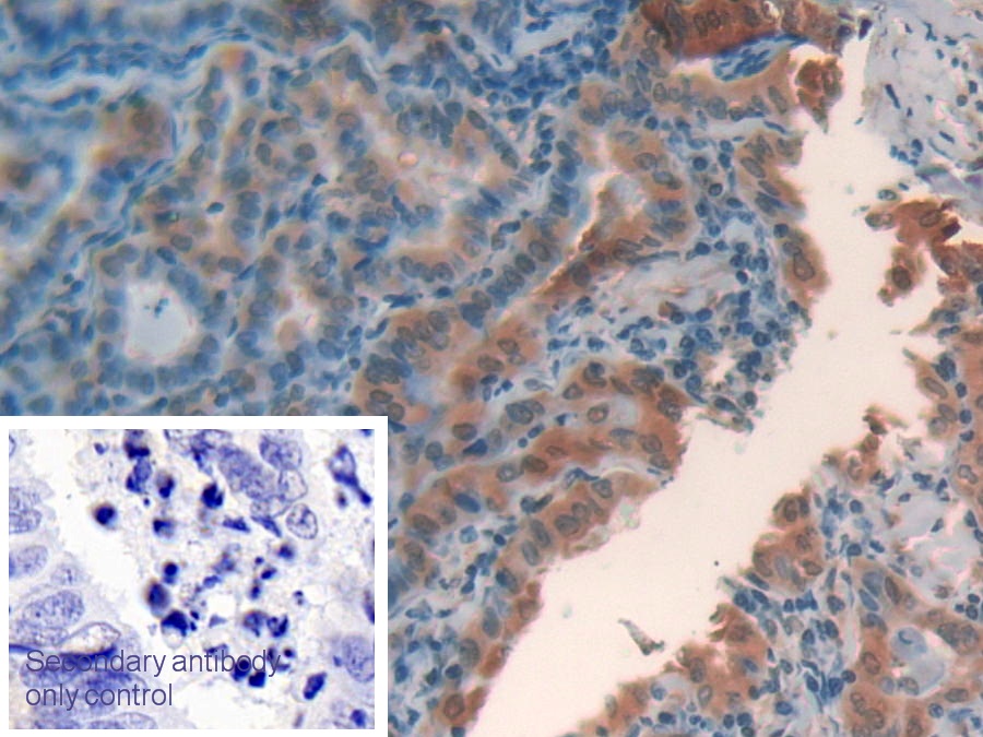 Polyclonal Antibody to Galectin 2 (GAL2)