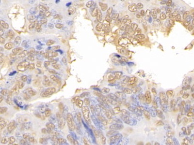 Polyclonal Antibody to Galectin 3 (GAL3)