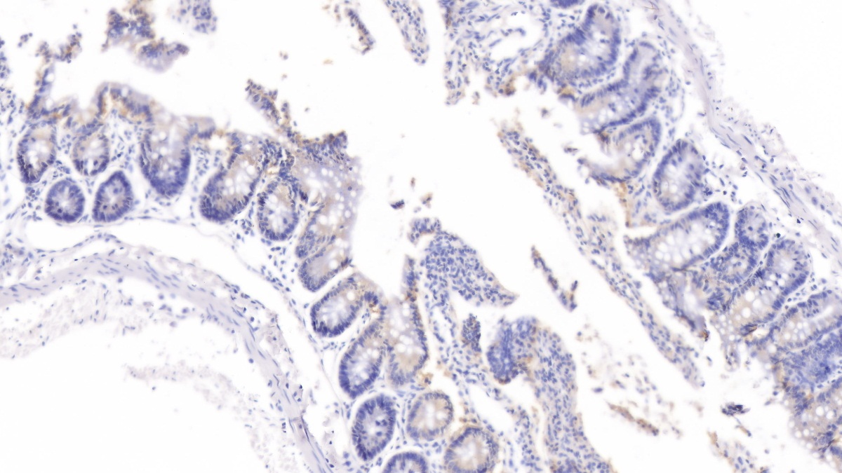 Polyclonal Antibody to Galectin 9 (GAL9)