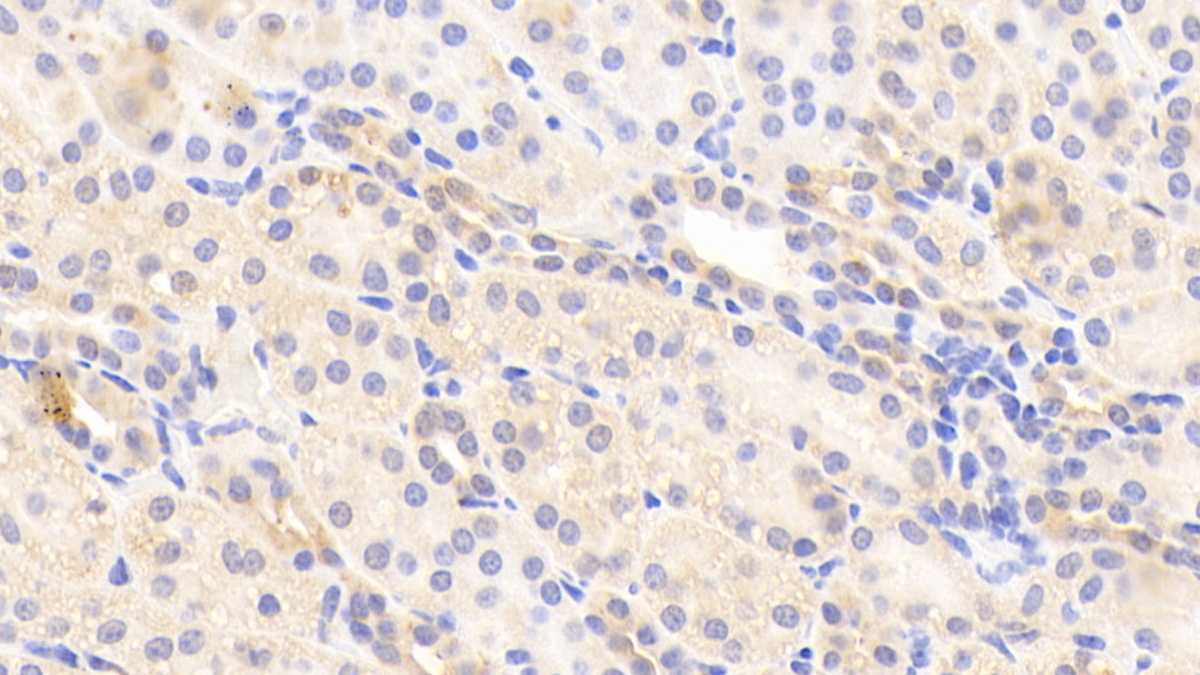 Polyclonal Antibody to Apolipoprotein H (APOH)