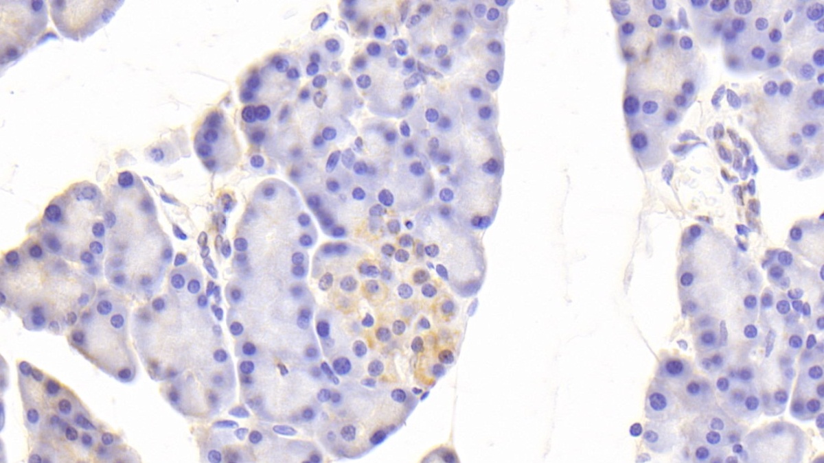 Polyclonal Antibody to Apolipoprotein H (APOH)