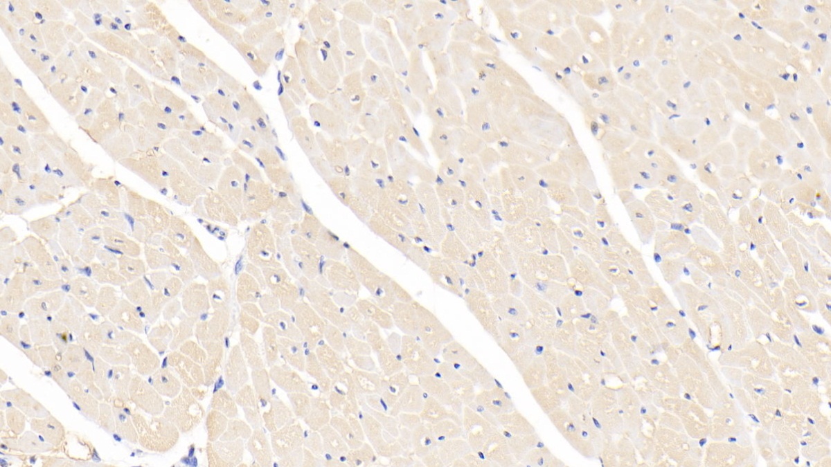 Polyclonal Antibody to Galectin 1 (GAL1)