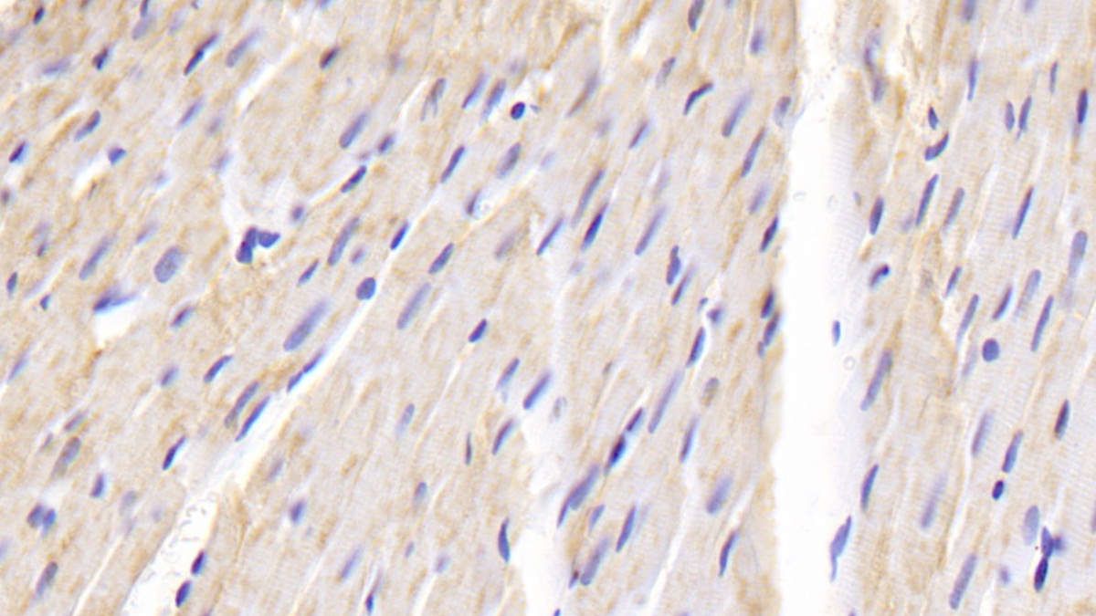 Polyclonal Antibody to Galectin 1 (GAL1)